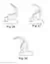 Fig. 12 - PROSTHETIC IMPLANTS FOR TOTAL KNEE ARTHROPLASTY