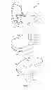 Fig. 02 - Posterior stabilized orthopaedic prosthesis