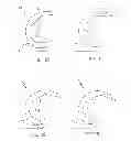 Fig. 06 - Posterior stabilized orthopaedic prosthesis