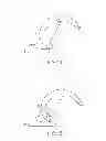 Fig. 07 - Posterior stabilized orthopaedic prosthesis