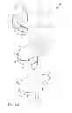 Fig. 11 - Posterior stabilized orthopaedic prosthesis