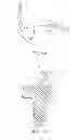 Fig. 12 - Posterior stabilized orthopaedic prosthesis