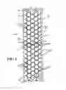 Fig. 02 - Mosaic implants, kits and methods for correcting bone defects