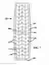 Fig. 08 - Mosaic implants, kits and methods for correcting bone defects