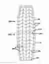 Fig. 09 - Mosaic implants, kits and methods for correcting bone defects