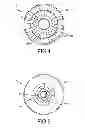 Fig. 04 - Transdermal prosthesis