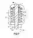 Fig. 07 - Transdermal prosthesis