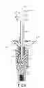 Fig. 09 - Transdermal prosthesis