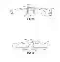Fig. 13 - Transdermal prosthesis
