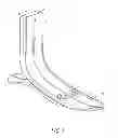 Fig. 02 - OVERMOULD ATTACHMENTS FOR PROSTHETIC FOOT