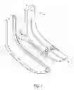 Fig. 03 - OVERMOULD ATTACHMENTS FOR PROSTHETIC FOOT