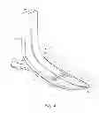 Fig. 07 - OVERMOULD ATTACHMENTS FOR PROSTHETIC FOOT