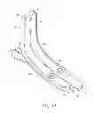 Fig. 11 - OVERMOULD ATTACHMENTS FOR PROSTHETIC FOOT