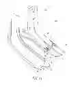 Fig. 12 - OVERMOULD ATTACHMENTS FOR PROSTHETIC FOOT