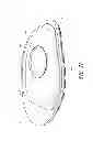 Fig. 22 - OVERMOULD ATTACHMENTS FOR PROSTHETIC FOOT