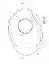 Fig. 23 - OVERMOULD ATTACHMENTS FOR PROSTHETIC FOOT