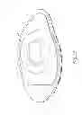 Fig. 34 - OVERMOULD ATTACHMENTS FOR PROSTHETIC FOOT
