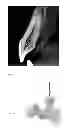 Fig. 05 - Endodontic treatment simulation system
