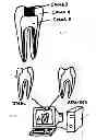 Fig. 07 - Endodontic treatment simulation system