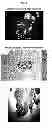 Fig. 06 - METHODS FOR DIAGNOSING DISEASES AND EVALUATING TREATMENTS THEREFOR USING PET
