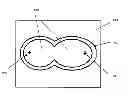 Fig. 01 - Treatment of teeth by aligners