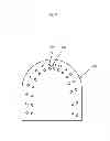 Fig. 09 - Treatment of teeth by aligners