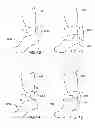 Fig. 06 - Apparel with Reduced Drag Coefficient
