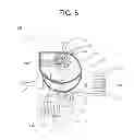 Fig. 06 - Apparatus for diverting fluid flow path