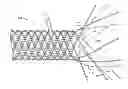 Fig. 01 - Methods for manufacturing secured strand end devices
