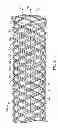Fig. 04 - Methods for manufacturing secured strand end devices