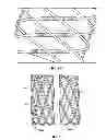 Fig. 06 - Methods for manufacturing secured strand end devices