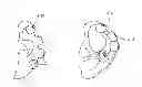 Fig. 01 - DECORATIVE EAR COVER AND METHOD OF MAKING SAME
