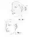 Fig. 06 - DECORATIVE EAR COVER AND METHOD OF MAKING SAME