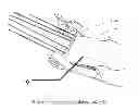 Fig. 01 - String changing device for Bigsby tailpieces