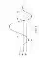 Fig. 08 - Velocity sensor for a plunger lift system