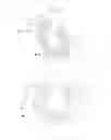 Fig. 11 - Switch