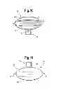 Fig. 11 - Flexible pouch and dock system