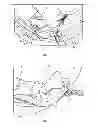 Fig. 06 - Air bag assembly and tether