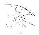 Fig. 02 - Airbag device for motor vehicles