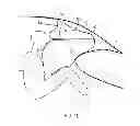 Fig. 07 - Airbag device for motor vehicles