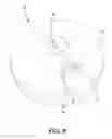 Fig. 11 - Carrier with Collapsible Wheel Assembly