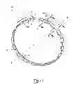Fig. 02 - Wheel bearing retainer