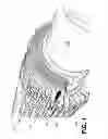 Fig. 02 - Laminated rotor machining enhancement