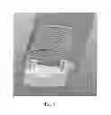 Fig. 02 - Patient support table top filler