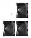 Fig. 07 - Vehicle vision system with dirt detection