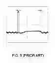Fig. 04 - INTEGRATED GATE DRIVER CIRCUIT AND LIQUID CRYSTAL PANEL