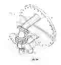 Fig. 02 - Mixer nozzle assembly