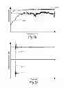 Fig. 07 - AUDIO PROCESSING AND ENHANCEMENT SYSTEM