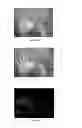 Fig. 02 - Object detection using difference of image frames
