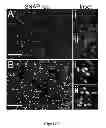 Fig. 02 - Soluble polypeptides